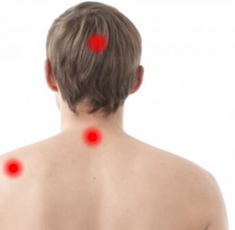 Žarišta osteohondroze